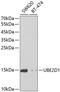 Ubiquitin Conjugating Enzyme E2 D1 antibody, GTX16400, GeneTex, Western Blot image 