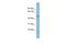 Chromosome 17 Open Reading Frame 75 antibody, A15957, Boster Biological Technology, Western Blot image 