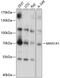 Mannosidase Alpha Class 1A Member 1 antibody, 13-824, ProSci, Western Blot image 