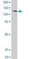 Sortilin Related VPS10 Domain Containing Receptor 2 antibody, H00057537-M03, Novus Biologicals, Western Blot image 