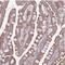 Armadillo Repeat Containing X-Linked 6 antibody, NBP2-30860, Novus Biologicals, Immunohistochemistry frozen image 