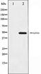 GATA Binding Protein 4 antibody, orb99437, Biorbyt, Western Blot image 