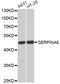 Serpin Family A Member 6 antibody, STJ28367, St John