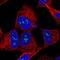 Tropomodulin 2 antibody, HPA041365, Atlas Antibodies, Immunofluorescence image 