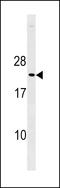 Cyclin Dependent Kinase Inhibitor 1B antibody, LS-C203813, Lifespan Biosciences, Western Blot image 