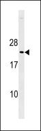 p27 antibody, LS-C203813, Lifespan Biosciences, Western Blot image 