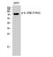 Interleukin 2 Receptor Subunit Beta antibody, STJ90530, St John