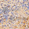 Colony Stimulating Factor 2 Receptor Alpha Subunit antibody, A3167, ABclonal Technology, Immunohistochemistry paraffin image 