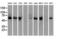 Checkpoint Kinase 2 antibody, LS-C114505, Lifespan Biosciences, Western Blot image 