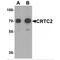 CREB Regulated Transcription Coactivator 2 antibody, MBS153722, MyBioSource, Western Blot image 