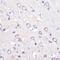 Stathmin 1 antibody, GTX32899, GeneTex, Immunohistochemistry paraffin image 