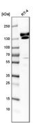 Kinectin 1 antibody, NBP1-90634, Novus Biologicals, Western Blot image 