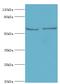 Far Upstream Element Binding Protein 3 antibody, MBS1497630, MyBioSource, Western Blot image 