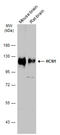 Hyperpolarization Activated Cyclic Nucleotide Gated Potassium Channel 1 antibody, GTX131334, GeneTex, Western Blot image 