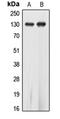 EPH Receptor A5 antibody, LS-C352162, Lifespan Biosciences, Western Blot image 