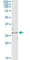 Testis Specific Serine Kinase 3 antibody, MA5-24575, Invitrogen Antibodies, Immunoprecipitation image 