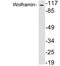 Wolframin ER Transmembrane Glycoprotein antibody, LS-B10927, Lifespan Biosciences, Western Blot image 