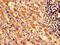 Suppressor Of Cytokine Signaling 3 antibody, LS-C396709, Lifespan Biosciences, Immunohistochemistry paraffin image 