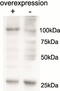 Beta-2-Microglobulin antibody, 43-049, ProSci, Enzyme Linked Immunosorbent Assay image 