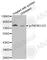 Phosphoinositide-3-Kinase Regulatory Subunit 1 antibody, AP0427, ABclonal Technology, Western Blot image 