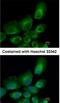 Ubiquitin-conjugating enzyme E2 B antibody, NBP1-31293, Novus Biologicals, Immunocytochemistry image 