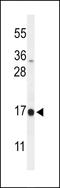 DAZ Associated Protein 2 antibody, LS-C167274, Lifespan Biosciences, Western Blot image 