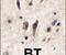 Tie-1 antibody, PA5-14743, Invitrogen Antibodies, Immunohistochemistry frozen image 