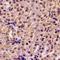 4-aminobutyrate aminotransferase, mitochondrial antibody, LS-C482413, Lifespan Biosciences, Immunohistochemistry paraffin image 