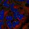 BMI1 Proto-Oncogene, Polycomb Ring Finger antibody, HPA030471, Atlas Antibodies, Immunofluorescence image 