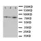 Minichromosome Maintenance Complex Component 5 antibody, orb76167, Biorbyt, Western Blot image 