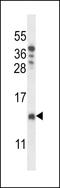 Cytochrome C Oxidase Assembly Factor 4 Homolog antibody, LS-C159342, Lifespan Biosciences, Western Blot image 