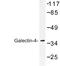 L-36 lactose-binding protein antibody, LS-C177039, Lifespan Biosciences, Western Blot image 