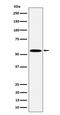 Bifunctional polynucleotide phosphatase/kinase antibody, M03566, Boster Biological Technology, Western Blot image 
