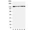 Telomerase Reverse Transcriptase antibody, R30782, NSJ Bioreagents, Western Blot image 