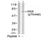 Eukaryotic Translation Initiation Factor 2 Alpha Kinase 2 antibody, 79-227, ProSci, Western Blot image 