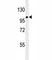 Zinc Finger E-Box Binding Homeobox 1 antibody, F53528-0.1ML, NSJ Bioreagents, Western Blot image 