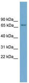 Protein Kinase C Eta antibody, TA345139, Origene, Western Blot image 