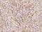 Matrix Metallopeptidase 15 antibody, 200301-T08, Sino Biological, Immunohistochemistry paraffin image 