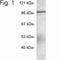 Amyloid Beta Precursor Protein Binding Family A Member 3 antibody, NB120-3450, Novus Biologicals, Western Blot image 