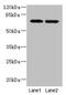 Neuropilin And Tolloid Like 2 antibody, CSB-PA818759LA01HU, Cusabio, Western Blot image 