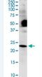 ER Membrane Protein Complex Subunit 8 antibody, H00010328-M01-100ug, Novus Biologicals, Western Blot image 