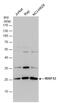 NADH:Ubiquinone Oxidoreductase Core Subunit S3 antibody, GTX113504, GeneTex, Western Blot image 