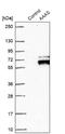 Aladin WD Repeat Nucleoporin antibody, NBP1-89424, Novus Biologicals, Western Blot image 