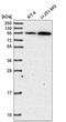 ADAM 17 antibody, NBP2-58422, Novus Biologicals, Western Blot image 