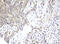 ADP Ribosylation Factor Like GTPase 2 Binding Protein antibody, M07607-1, Boster Biological Technology, Immunohistochemistry paraffin image 