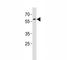 Paired Box 3 antibody, F48343-0.4ML, NSJ Bioreagents, Immunohistochemistry paraffin image 