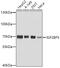 Insulin Like Growth Factor 2 MRNA Binding Protein 3 antibody, GTX32680, GeneTex, Western Blot image 
