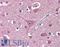 Phosphoribosyl Pyrophosphate Amidotransferase antibody, LS-B9407, Lifespan Biosciences, Immunohistochemistry paraffin image 