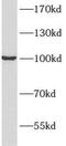 ATPase Na+/K+ Transporting Subunit Alpha 2 antibody, FNab00693, FineTest, Western Blot image 