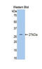 Interleukin 4 Receptor antibody, LS-C294912, Lifespan Biosciences, Western Blot image 